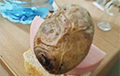 Фотофакт: В Слонимской больнице пациентов кормят картошкой в мундирах