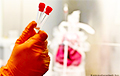 Тест на антитела к коронавирусу можно сделать в частных лабораториях по всей Беларуси