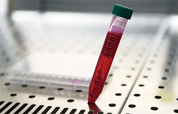 В Беларуси можно бесплатно сдать тест на антитела к коронавирусу.