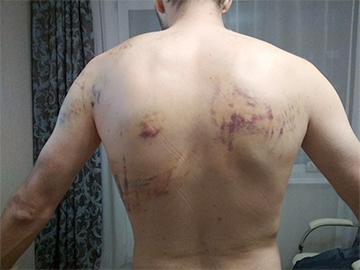 «Забирали сокамерника на каталке с полной фиксацией»