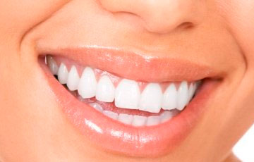 Какие продукты невероятно полезны для зубов?