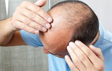 Belarusian Scientists Develop Remedy Against Baldness