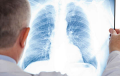 Increased Lung Inflammation Cases In Babruisk Prison #2