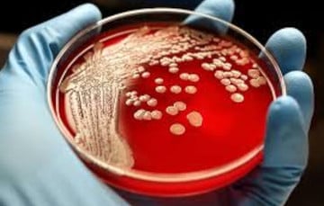 В Беларуси скрывают более 300 очагов смертельно опасной болезни