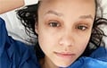 A Belarusian Woman On A Polish Hospital: I Watched It With Tenderness