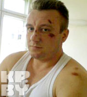 Милиционеры жестоко избили жителя Брагина из-за фликера (Фото)