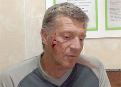 Beaten by militia Aleh Surhan got 6 months in jail