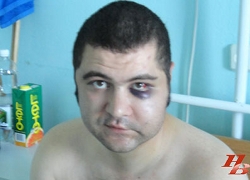 Beaten by police Andrei Mouchan cannot get his medical record