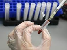 Беларуси грозит эпидемия ВИЧ?