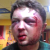 FEMEN ideologist severely beaten in Kiev