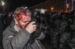 «Репортеры без границ»: Целенаправленные атаки на журналистов неприемлемы
