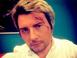 Басков получил травму головы на свадьбе дочери Игоря Крутого