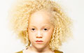 Афроамериканка-альбинос покорила модную индустрию